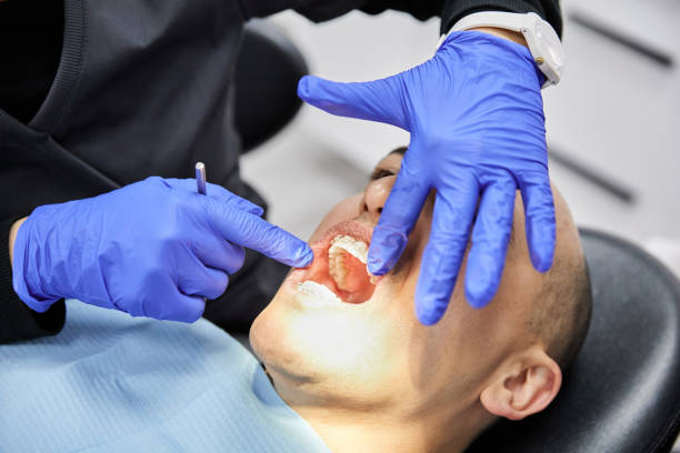Best Emergency Dentist for Knocked-Out Tooth in Mi Wuk Village, CA