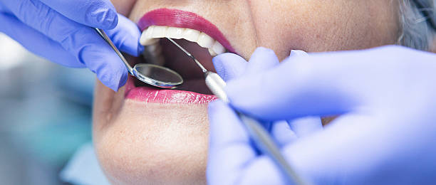Best Mobile Emergency Dentist in Mi Wuk Village, CA
